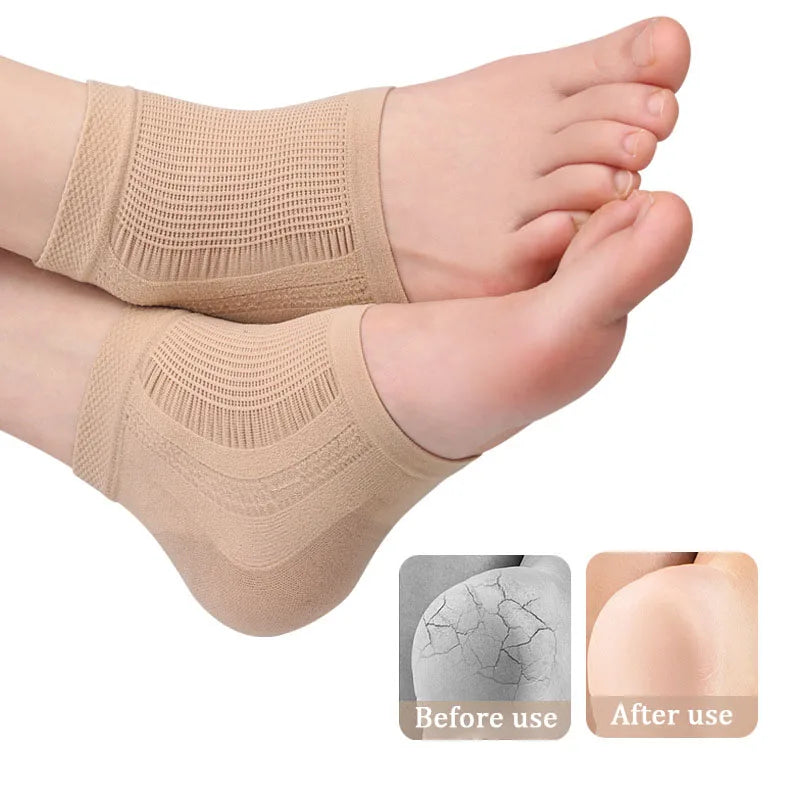 Protector de talón de malla de silicona de gel, calcetines de talón, fundas para los pies, hidratantes, antidesgaste, antigrietas, calcetines cortos, almohadillas de cubierta de talón.