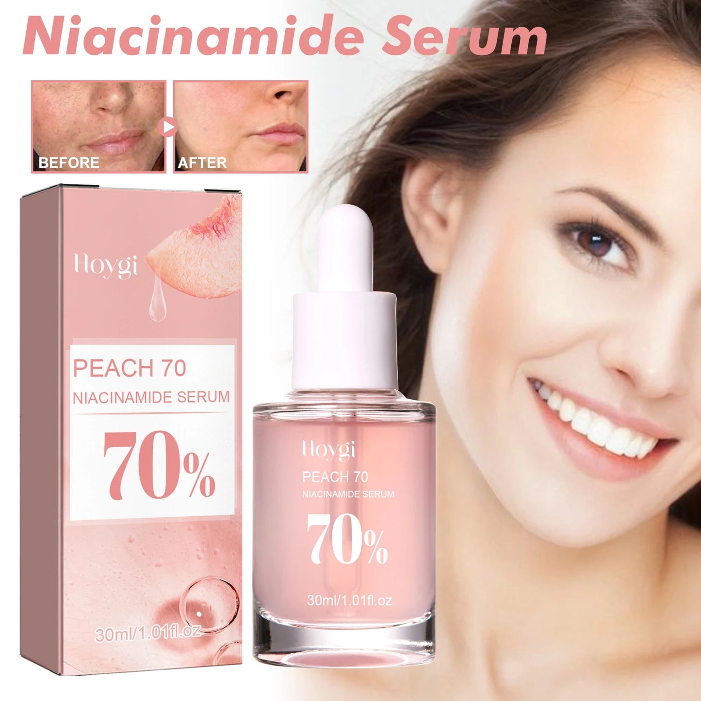 Sérum Niacinamida 30ml, minimizador de poros iluminador, difumina las manchas oscuras, hidratante, unifica el tono, antienvejecimiento, para el rostro, no irritante