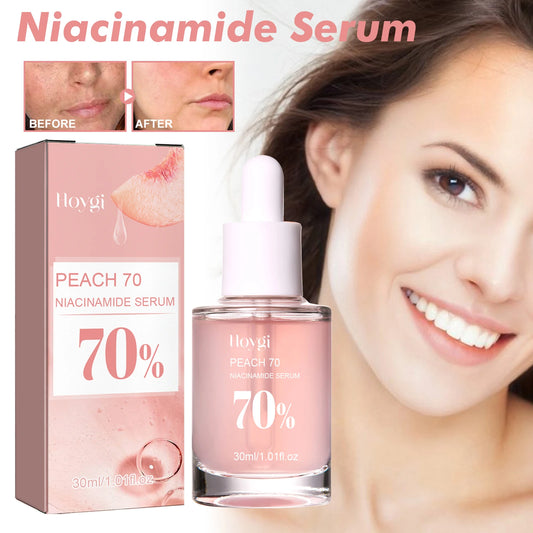 Sérum Niacinamida 30ml, minimizador de poros iluminador, difumina las manchas oscuras, hidratante, unifica el tono, antienvejecimiento, para el rostro, no irritante