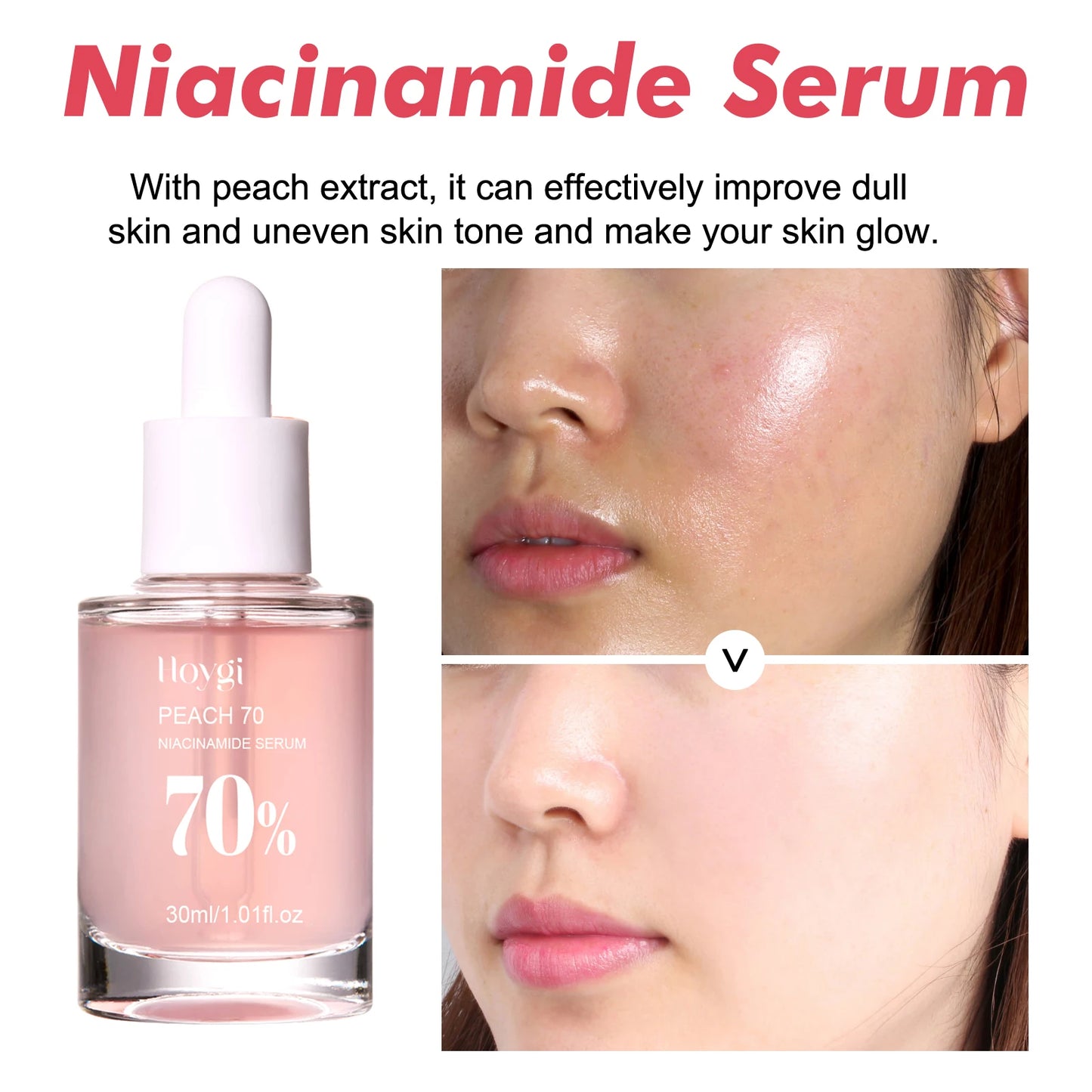 Sérum Niacinamida 30ml, minimizador de poros iluminador, difumina las manchas oscuras, hidratante, unifica el tono, antienvejecimiento, para el rostro, no irritante