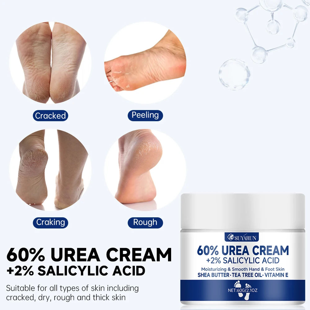 SUYARUN 60% Urea Foot Cream for Cracked Heels and Dry Skin - Intensive Moisturizing Treatment, Callus Remover, Diabetic Foot Care.