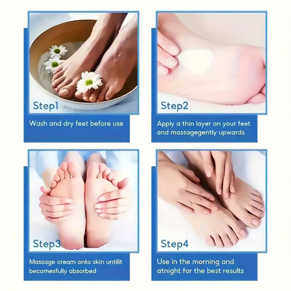 SUYARUN 60% Urea Foot Cream for Cracked Heels and Dry Skin - Intensive Moisturizing Treatment, Callus Remover, Diabetic Foot Care.