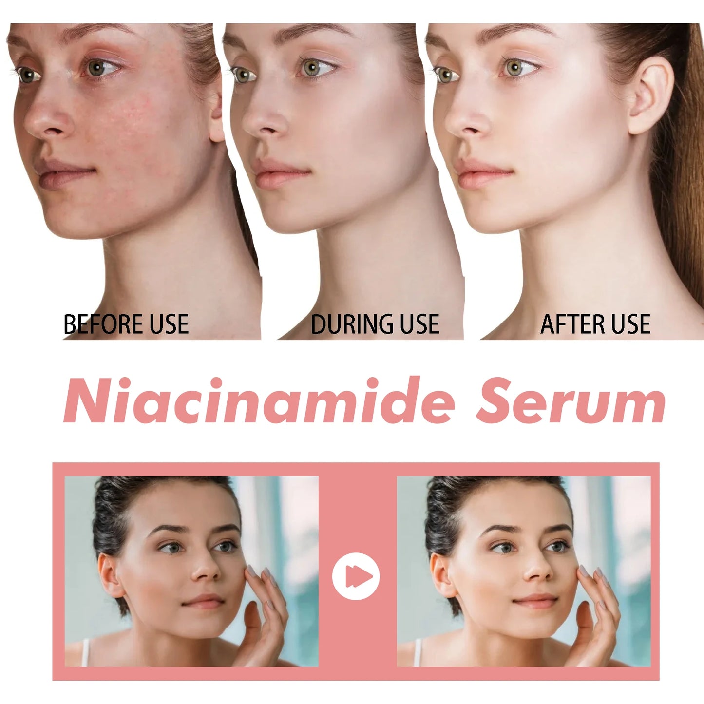 Sérum Niacinamida 30ml, minimizador de poros iluminador, difumina las manchas oscuras, hidratante, unifica el tono, antienvejecimiento, para el rostro, no irritante