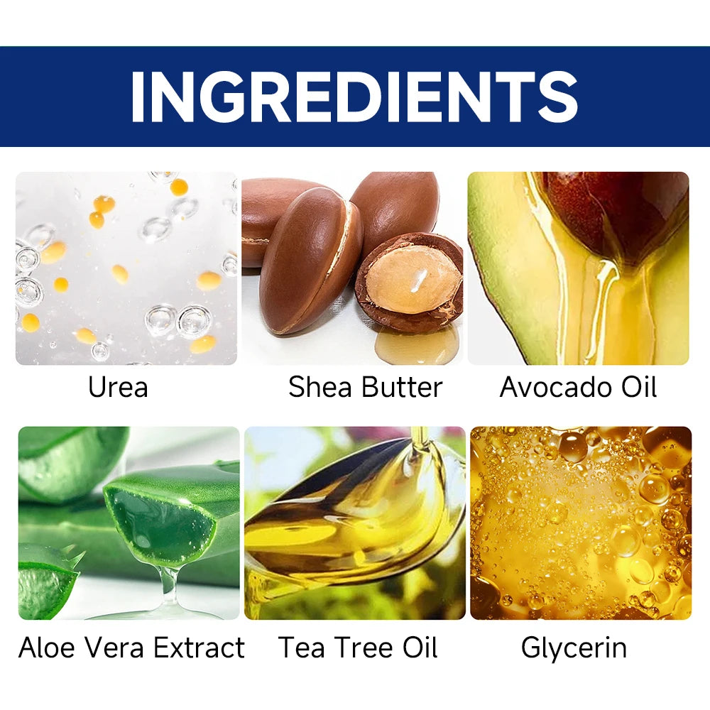 SUYARUN 60% Urea Foot Cream for Cracked Heels and Dry Skin - Intensive Moisturizing Treatment, Callus Remover, Diabetic Foot Care.