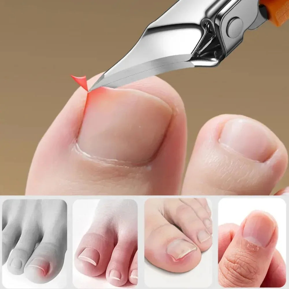 25 °   Coupe-ongles à bord incliné, large ouverture en acier inoxydable, outils professionnels pour ongles incarnés, bec d'aigle, coupe-ongles obliques